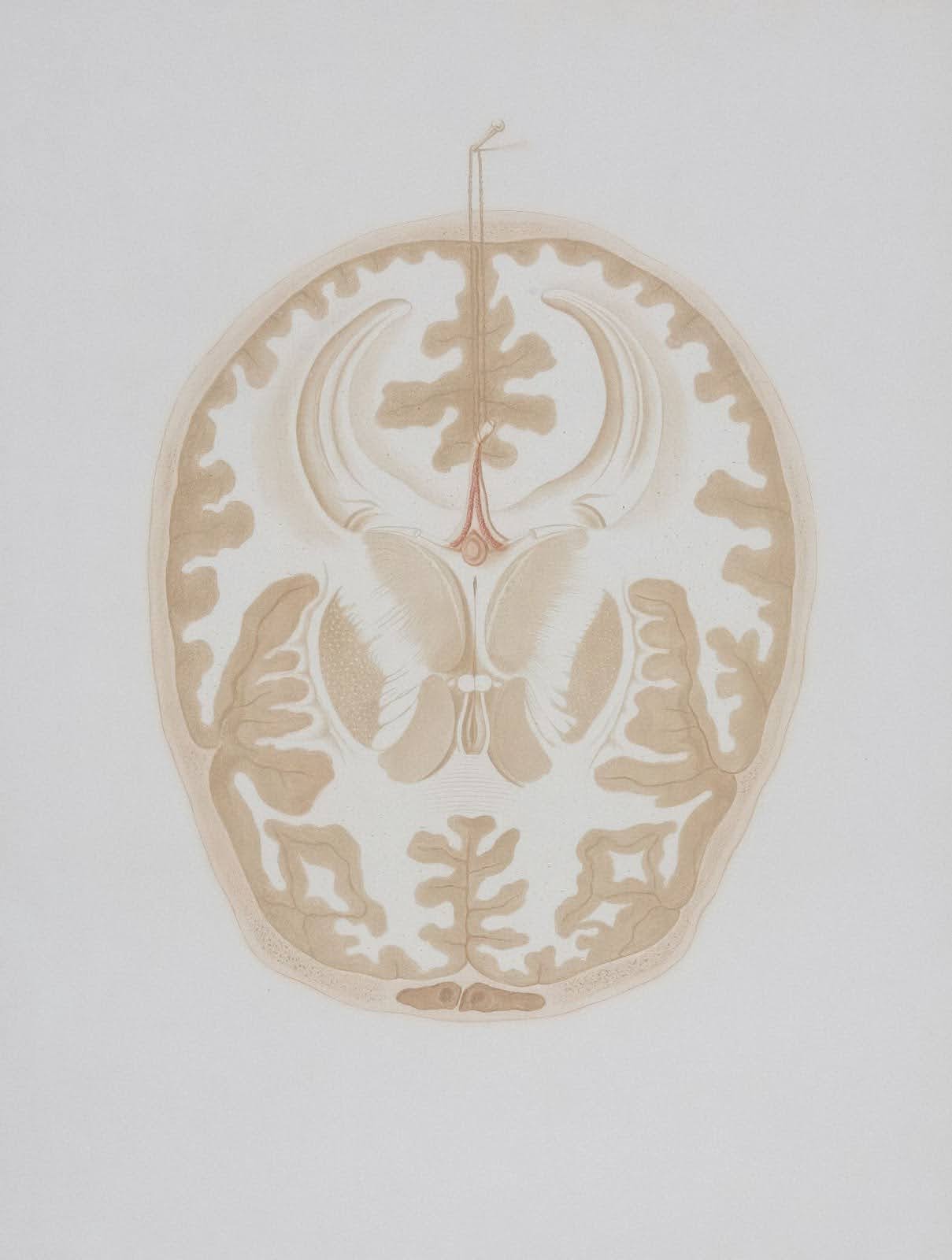 Trauma, the Brain, and Accelerated Resolution Therapy (ART)